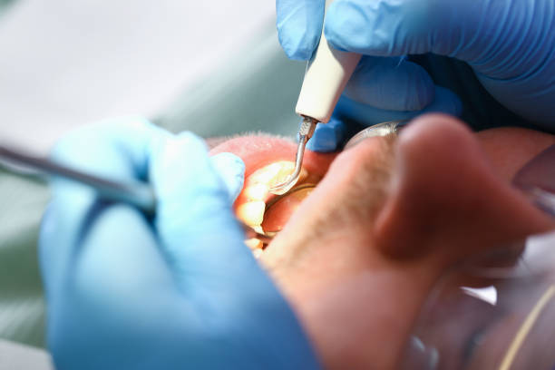Best Emergency Broken Tooth Repair in Wortham, TX