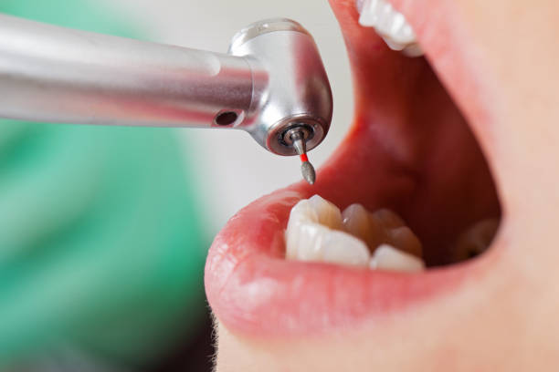 Best Emergency Dental Surgery in Wortham, TX